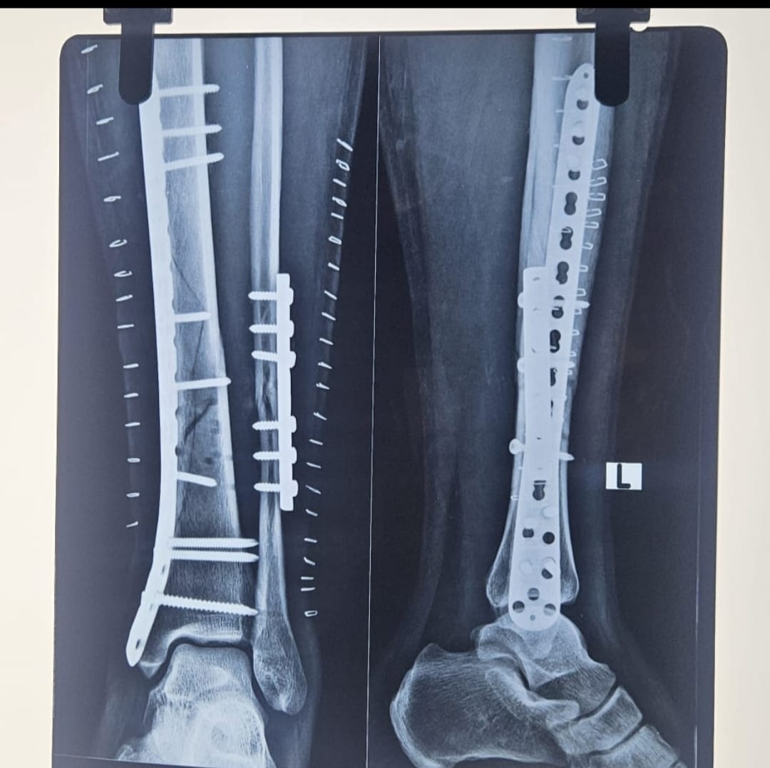 Orthopedic Gallery